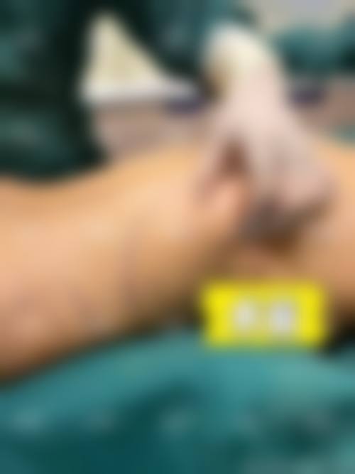 六、广州澳玛经典整形医院怎么预约：