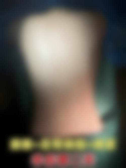 五、广州澳玛经典整形医院实例