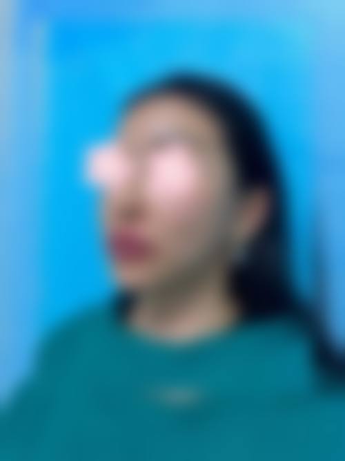 四、韩国A特整形外科医院开展的主要项目和特色项目：