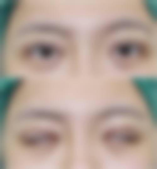 阳海斌医生怎么预约？