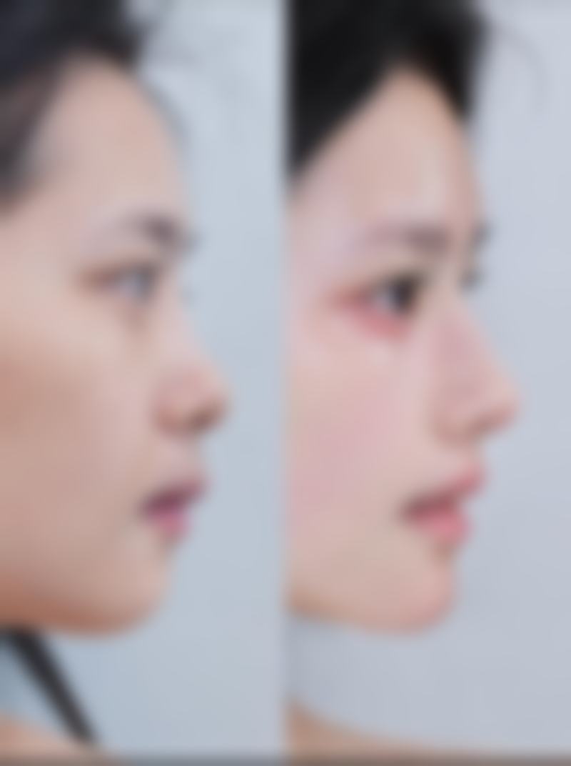 六、韩国A特整形外科医院怎么预约：