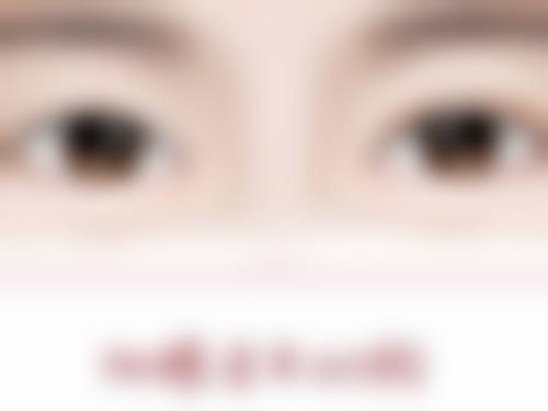 如何消除红色凹陷疤痕？揭秘有效修复方法，促进肌肤再生焕新光彩 