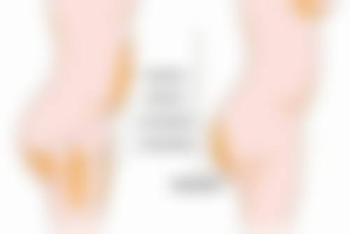 疤痕体质的疤痕去除难题怎么破？手术治疗应对复杂疤痕