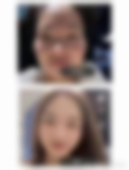 四、石河子贝芙丽整形医院实例