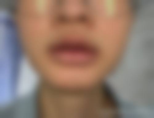 八、北京爱斯克外科门诊部真实的顾客评价如下：