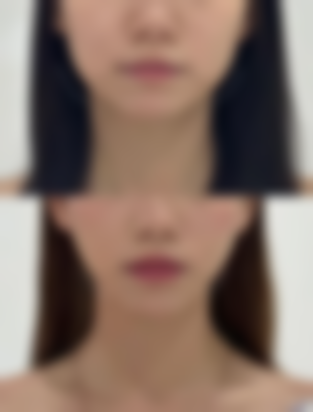 五、广州新颜医疗美容门诊怎么预约：