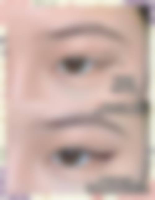 五、上海星和医疗美容医院实例