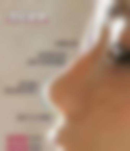 八、乌鲁木齐昕容妍医疗美容医院真实的顾客评价如下：