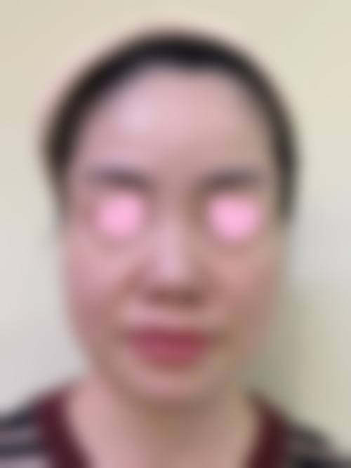 六、上海星和医疗美容医院怎么预约：