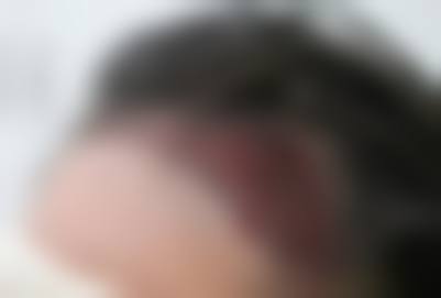 李自克医生怎么样可靠吗？