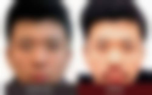 李自克医生在哪家医院怎么预约？