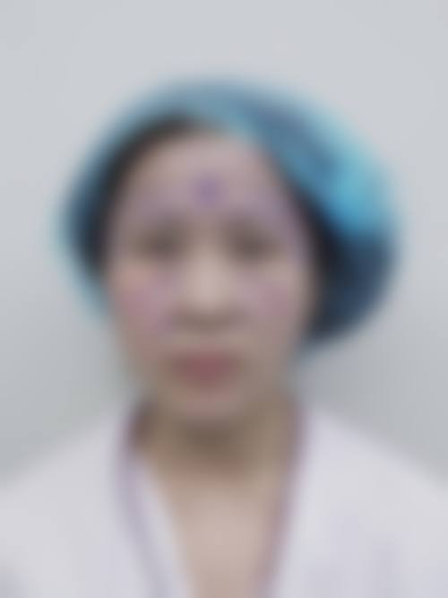 五、广州医选医疗美容实例