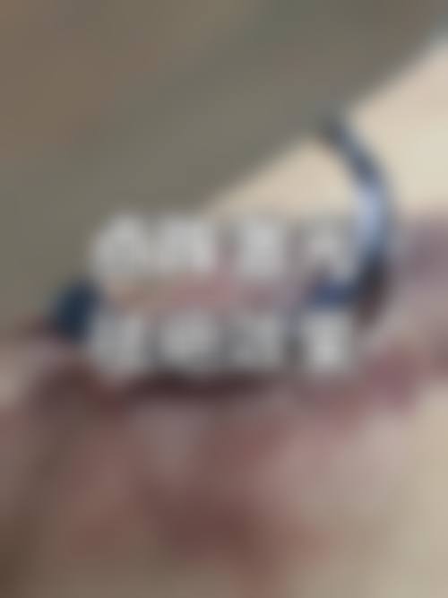 易湘豪医生在哪家医院怎么预约？