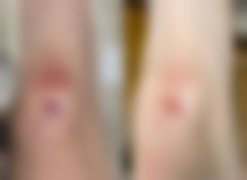 易湘豪医生实例