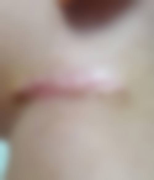 易湘豪医生口碑和评价