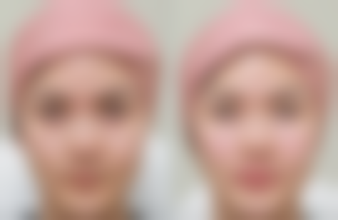 五、国内台湾采妍整形医院怎么预约：