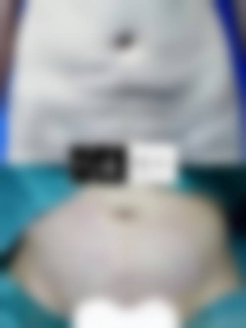 二、福州莎菲琳弘宇整形医院正规吗?来看看医院资质: