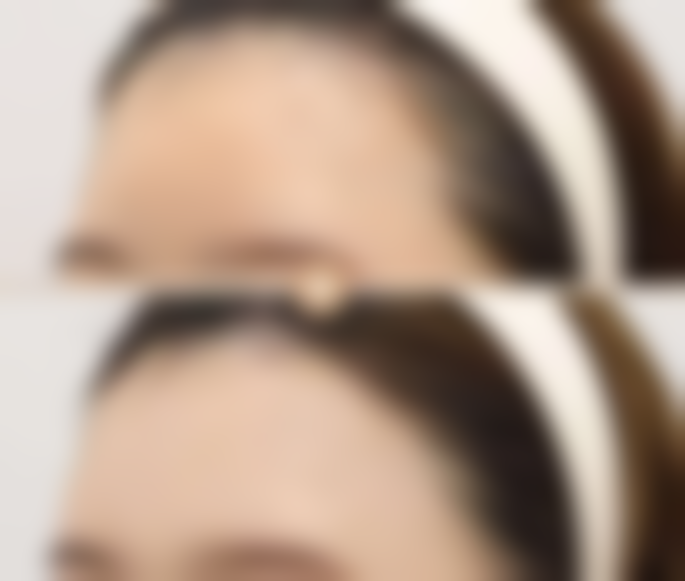 七、青岛卓雅医疗美容诊所真实的顾客评价如下：