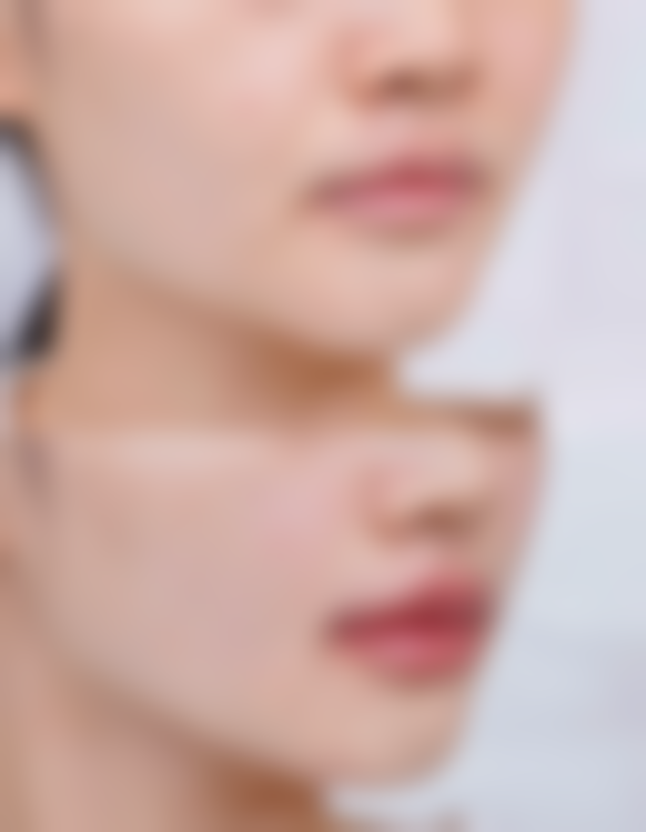 五、韩国清潭jasmin line整形医院怎么预约：