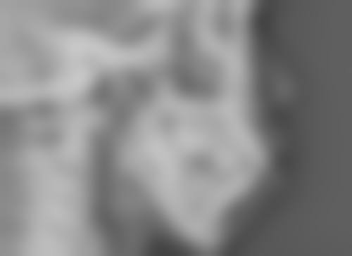 红霉素软膏真能祛眼袋吗？权威揭秘其作用局限与正规去眼袋干预方式