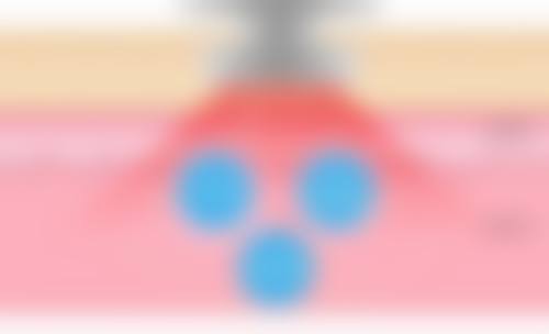 湖州吴兴曙光威兹曼医疗美容医院周顺利手术风格之个性化定制