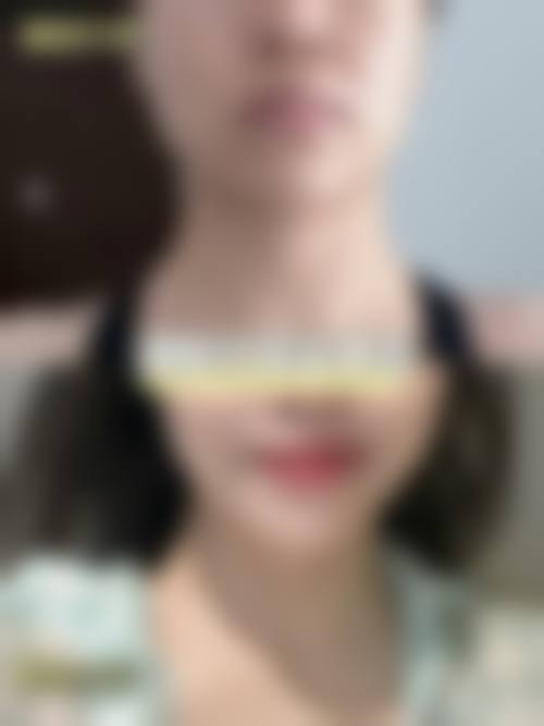 五、湖北芯微医疗美容门诊部怎么预约：