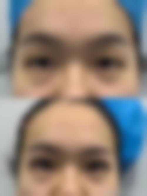 五、济南美姿整形医院实例