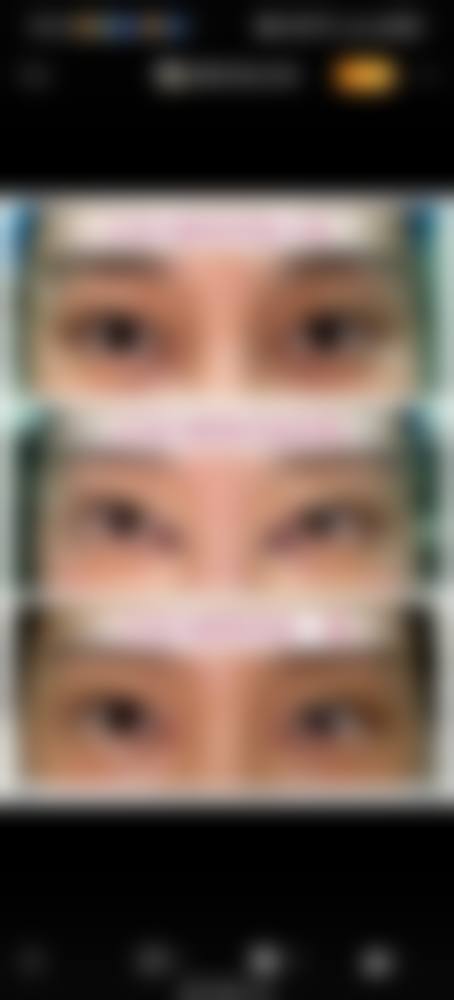 五、深圳西部烧伤整形医院实例