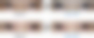 韩国吴金斯整形医院