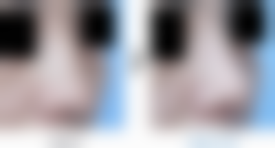 八、韩国吴金斯整形医院真实的顾客评价如下: