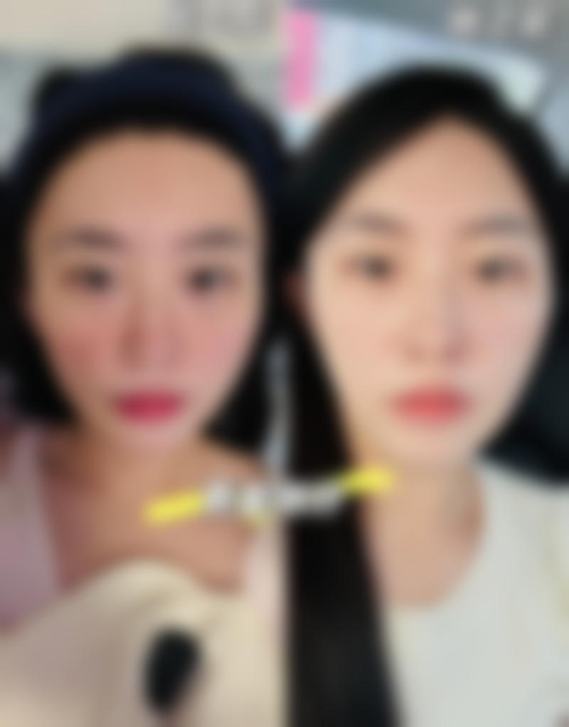 湖州吴兴曙光威兹曼医疗美容医院陈露医生预约方式