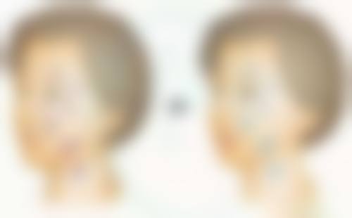 脸部烫伤疤痕去除有妙招？多手段治疗+精细护理，显著淡化疤痕不是梦 