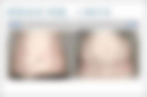 王红云医生怎么样可靠吗？