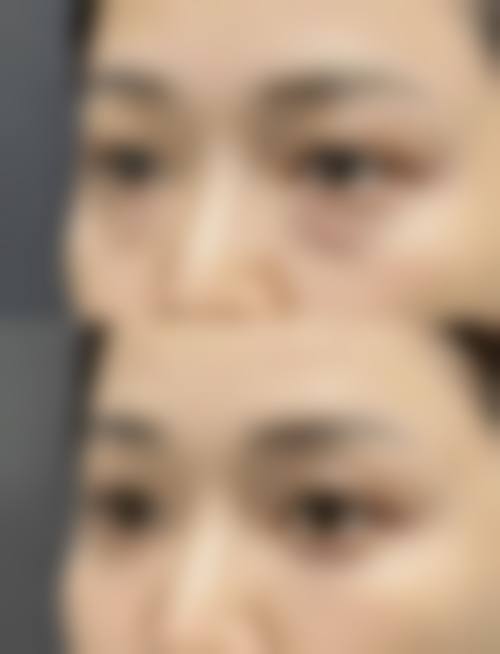 八、韩国View整形医院真实的顾客评价如下：