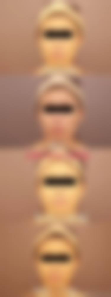 六、杭州缇咖整形医院价格表：（仅供参考）