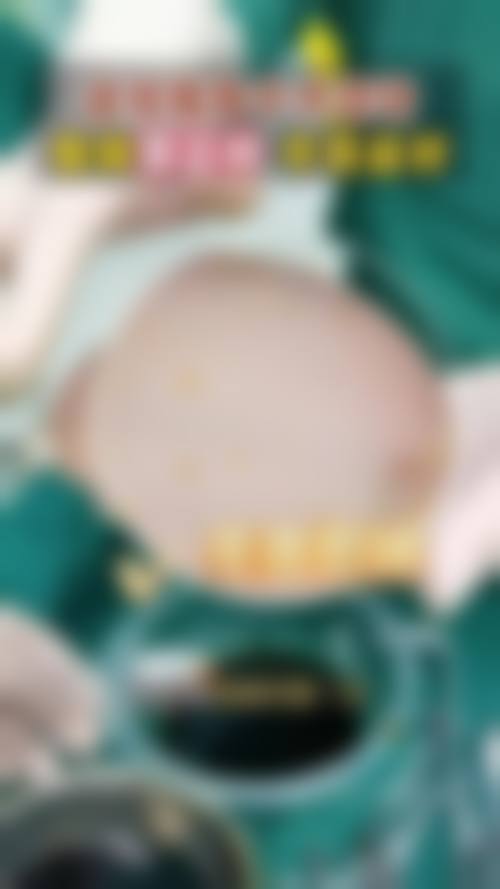 王德昌医生在哪家医院怎么预约？