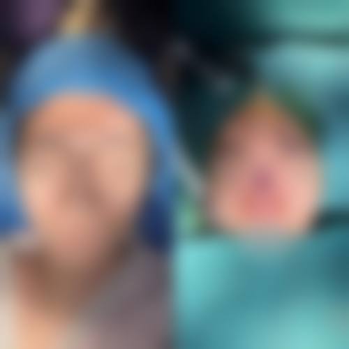 四、韩国纽莱茵整形（成都分院）实例