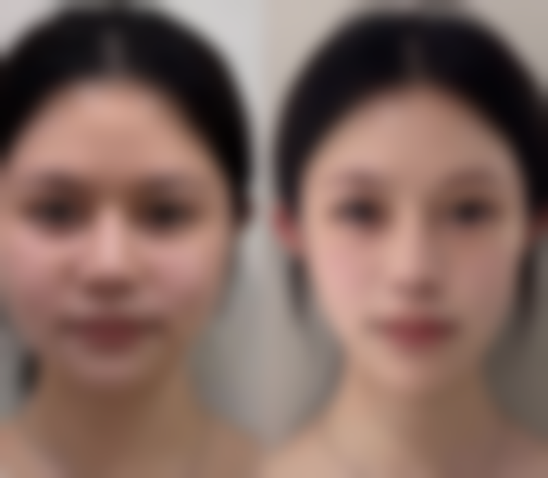 六、杭州奔竞整形医院怎么预约：