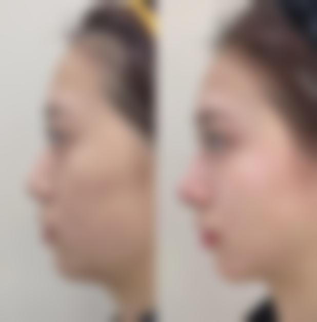 八、杭州奔竞整形医院真实的顾客评价如下：