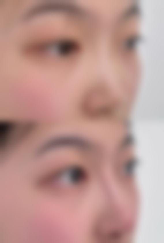 五、山东临沂悦美人整形医院实例