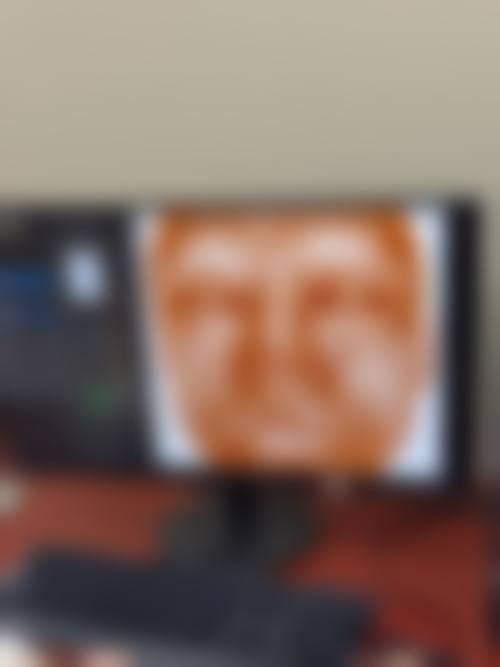 八、南京东南大学附属中大医院整形科真实的顾客评价如下: