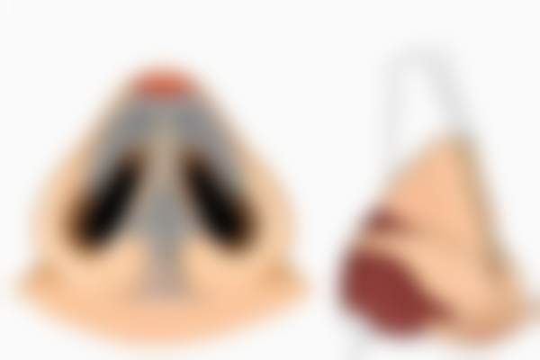 北京蕾士悦容医疗美容门诊部【轮廓固定】伊婉玻尿酸填充套餐真实评价