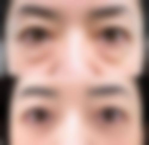 五、莆田学院附属医院整形外科实例