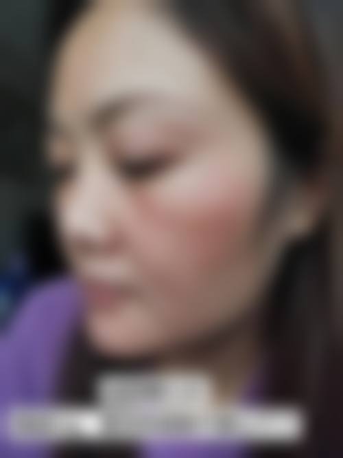 七、东莞南城知美整形美容门诊部真实的顾客评价如下: