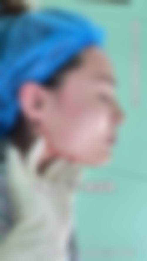 五、昆明三一一医院医学美容中 心实例