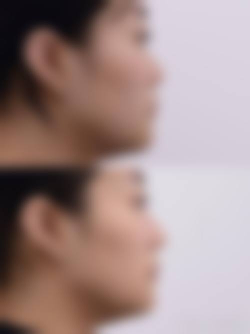 五、淮安苏美尔整形医院实例