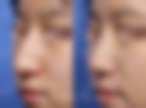 八、清远瑞丽整形医院真实的顾客评价如下：