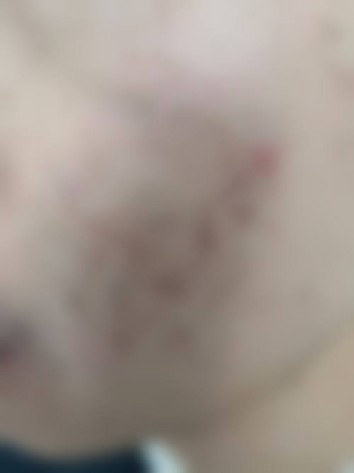 八、成都锦一医院皮肤美容科真实的顾客评价如下：