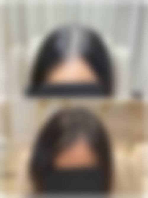 六、常州新生植发怎么预约: