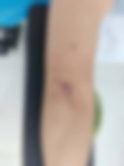 七、成都锦一医院皮肤美容科价格表：（仅供参考）